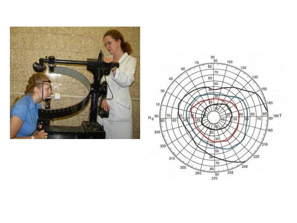 Периметрия в офтальмологии. Исследование полей зрения периметрия норма. Методика исследования поля зрения на периметре Ферстера. Периметр Форстера для определения поля зрения. Периметрия статическая периметр.